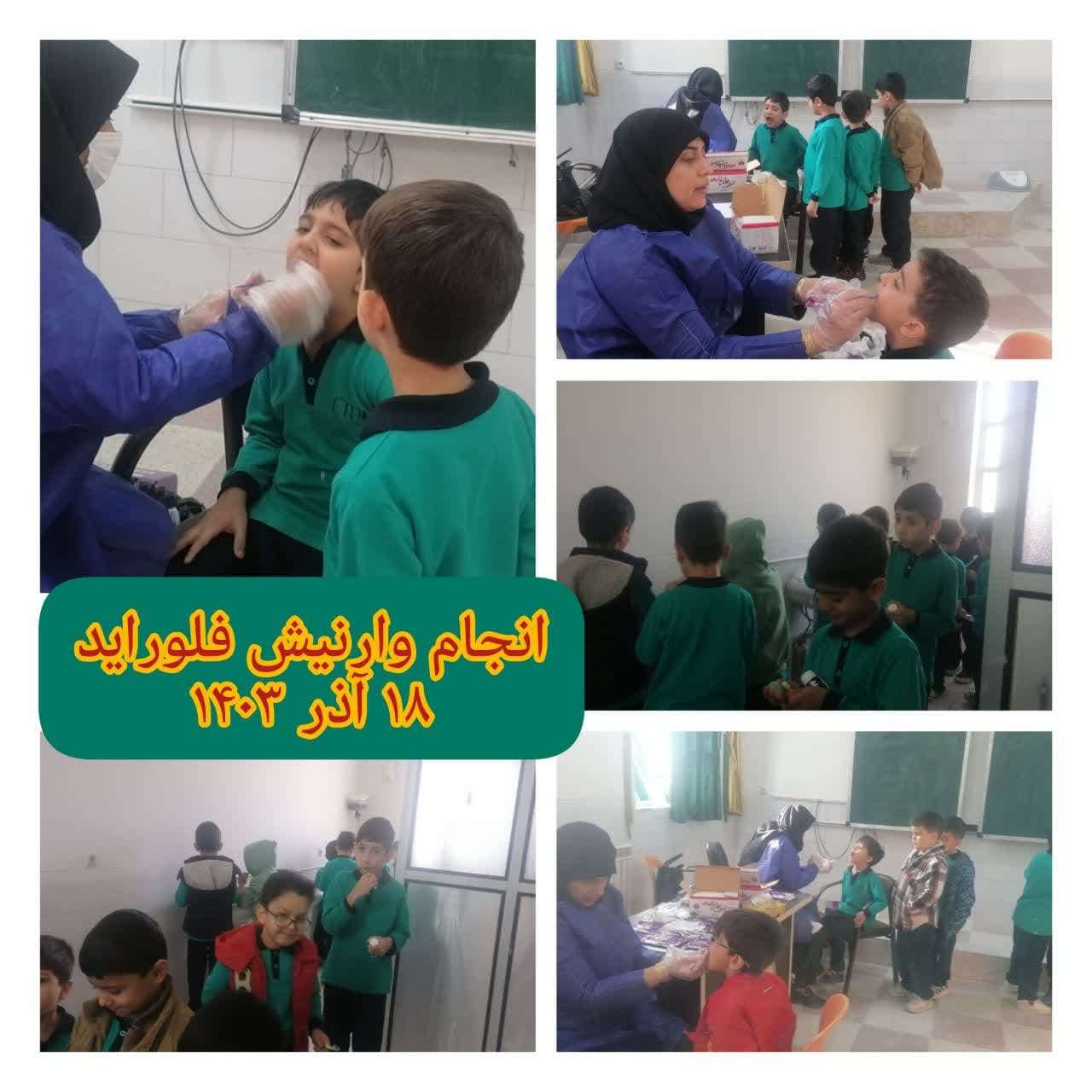 انجام خدمات وارنیش فلوراید